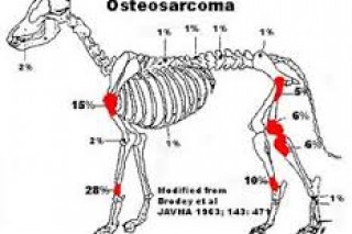 Osteosarcoma